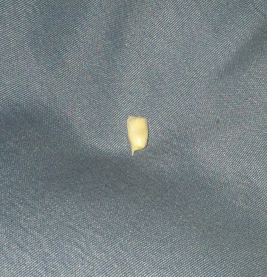 Buh-bye tooth!
